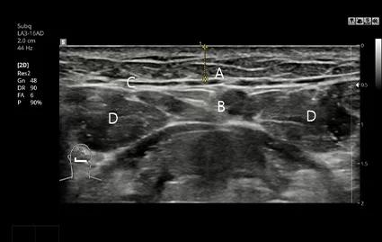 Pemindaian CT Sebelum Operasi