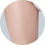 Liposuction result 4