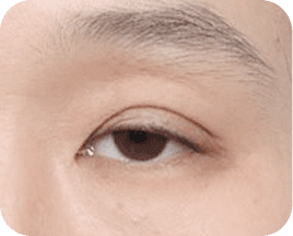 The Key to Beautiful Eyes