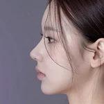 Keindahan Rhinoplasty