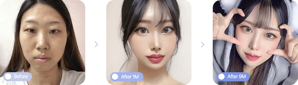 AB plastic surgery
