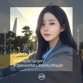 Operasi Mata, Operasi Kontur Wajah