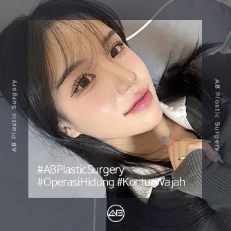 Rhinoplasty,Operasi Kontur Wajah
