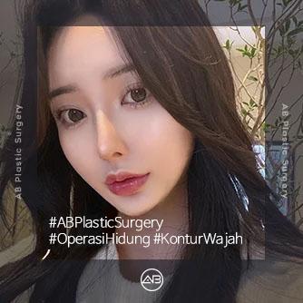 Rhinoplasty,Operasi Kontur Wajah