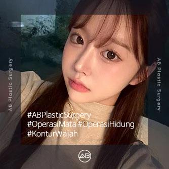 Mata,Rhinoplasty,Operasi Kontur Wajah