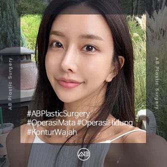 Mata,Rhinoplasty,Operasi Kontur Wajah