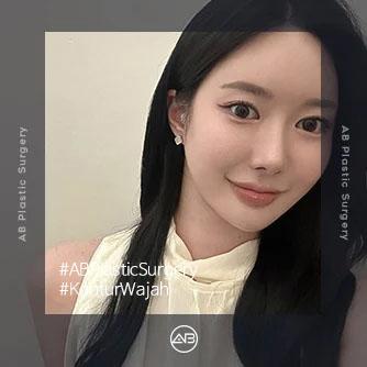 Operasi Kontur Wajah