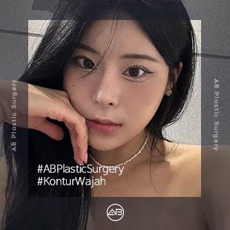Rhinoplasty,Operasi Kontur Wajah