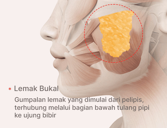 Terlihat lebih langsing, lemak bukal/lemak di pipi hilang.
