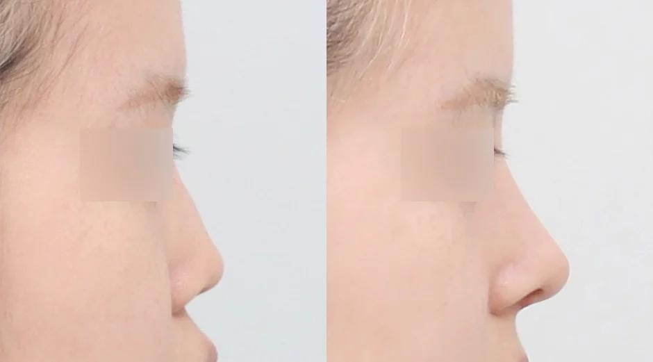 AB Plastic Surgery