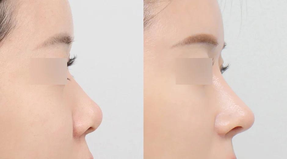 AB Plastic Surgery