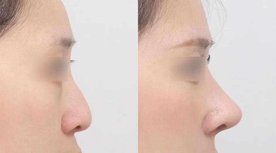 AB Plastic Surgery
