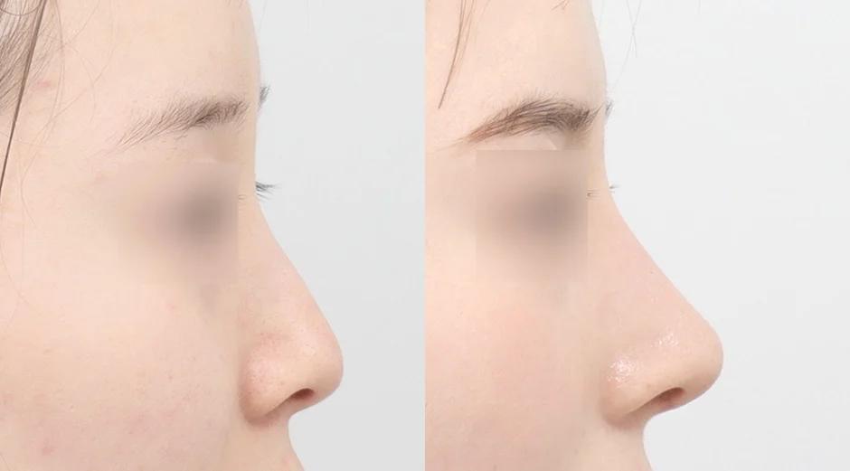AB Plastic Surgery