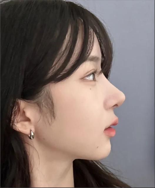 Naturally refined nose