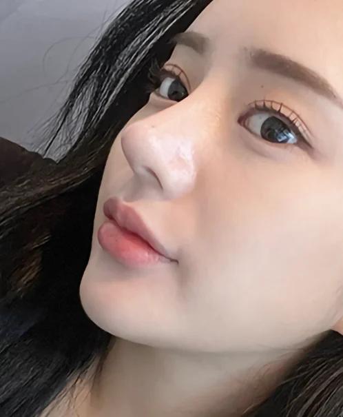 Glamorous nose tip