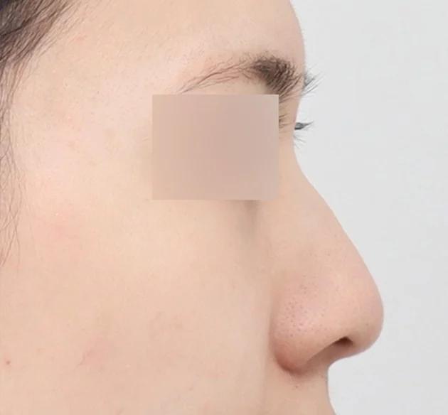 Ujung hidung glamor/glowing. before