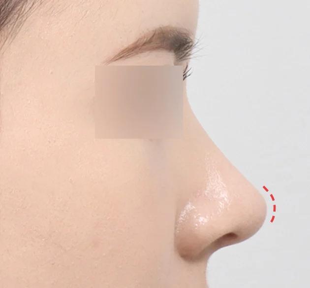 Ujung hidung glamor/glowing. after