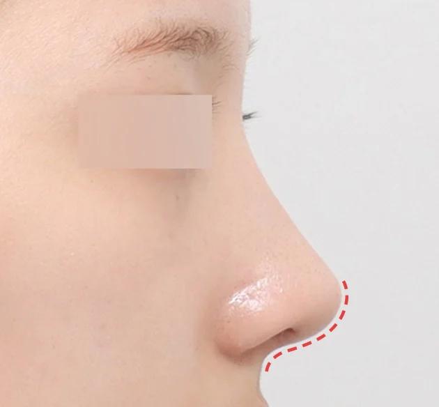 Bentuk hidung naturglow personal after