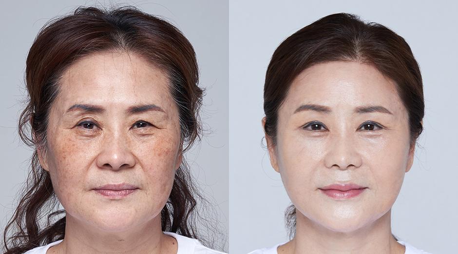 AB Plastic Surgery