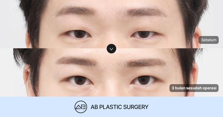 AB Plastic Surgery