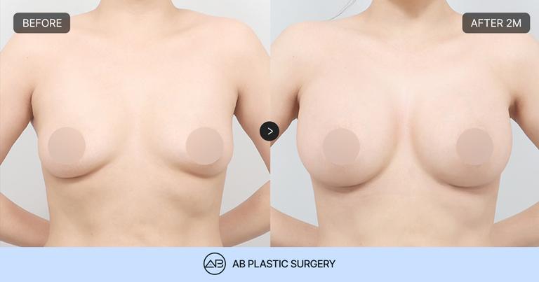 AB Plastic Surgery
