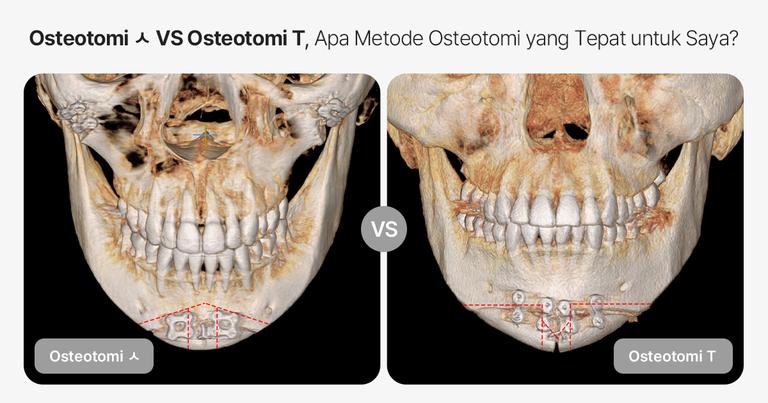 AB Plastic Surgery