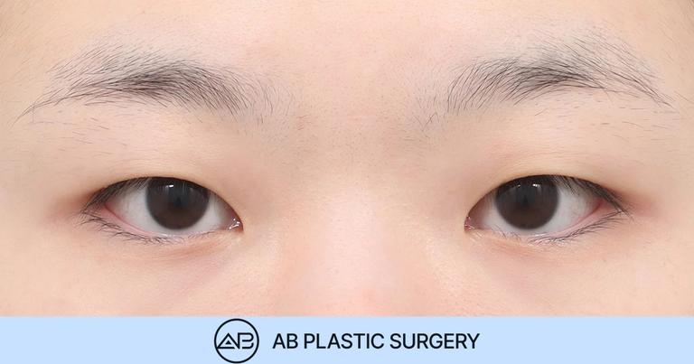 AB Plastic Surgery