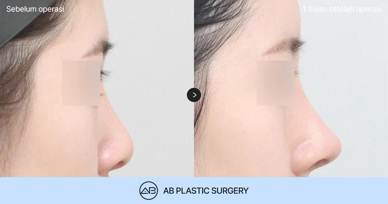 AB Plastic Surgery