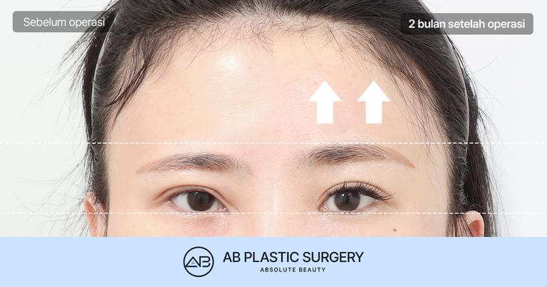 AB Plastic Surgery