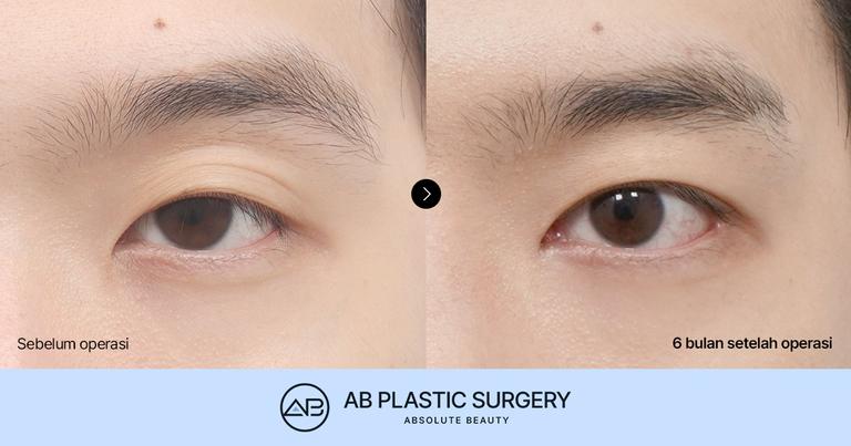 AB Plastic Surgery