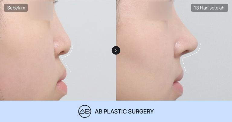 AB Plastic Surgery