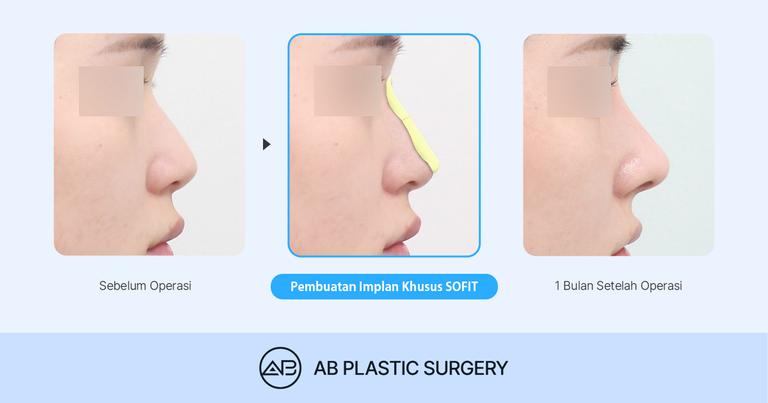 AB Plastic Surgery