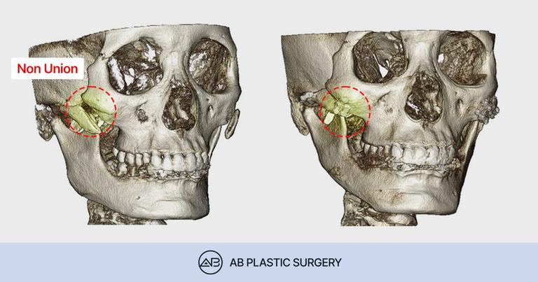 AB Plastic Surgery