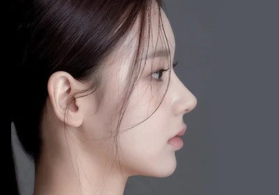 Awal Mula Keindahan Hidung, Hidung Indah AB