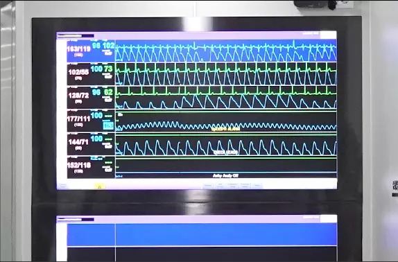 Sistem Pemantauan Pusat