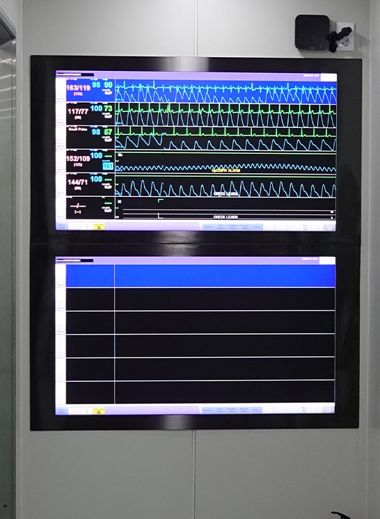 Pemantauan intensif oleh dokter
spesialis anestesi pribadi
