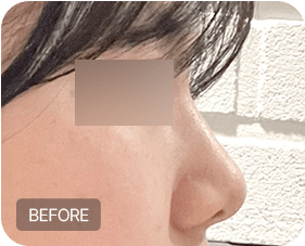 Before and after 2-1