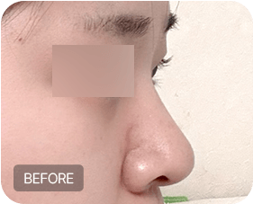 Before and after 3-1
