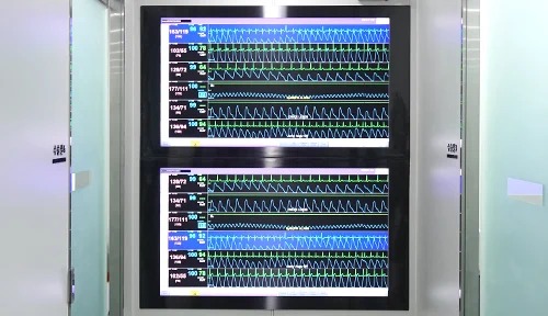Pengawasan Real-Time