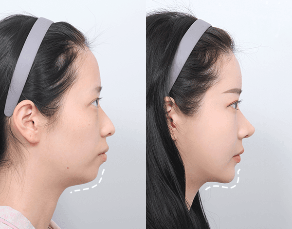 Desain yang dirancang secara personal dengan mempertimbangkan seluruh wajah