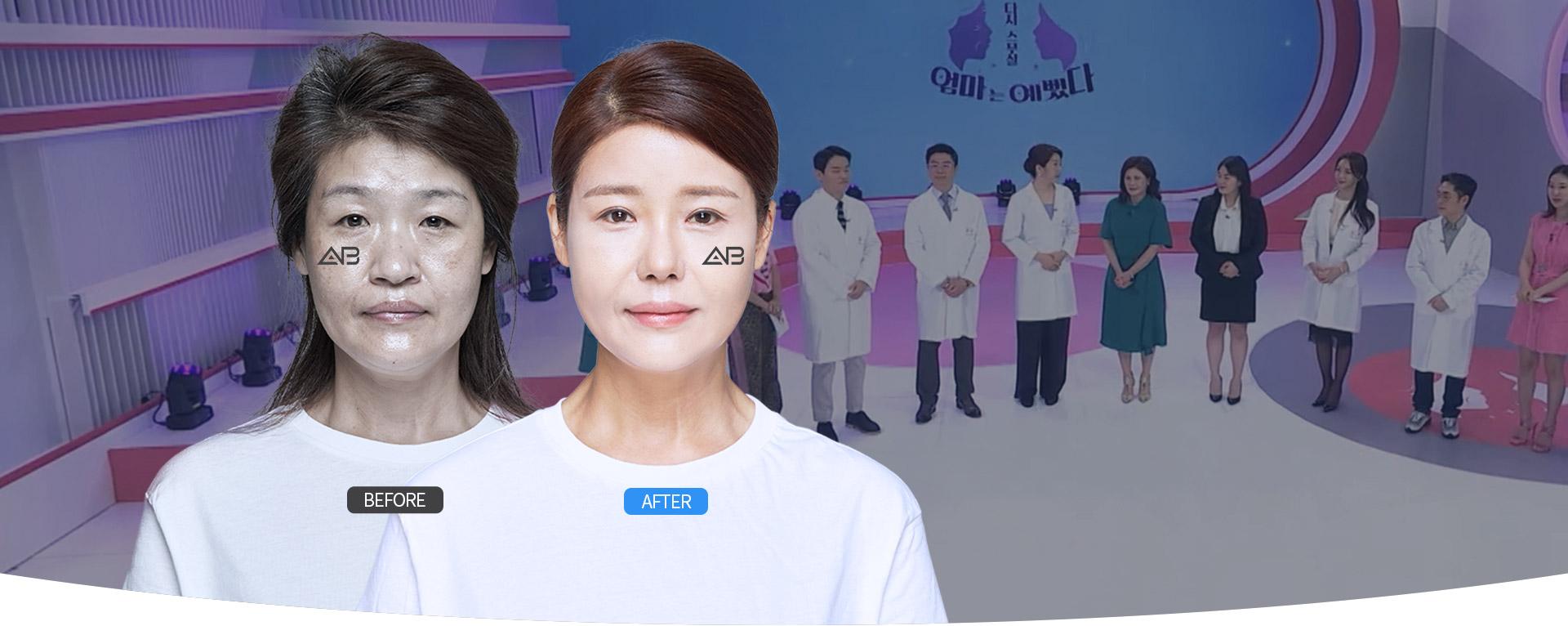 AB PLASTIC SURGERY EVENT