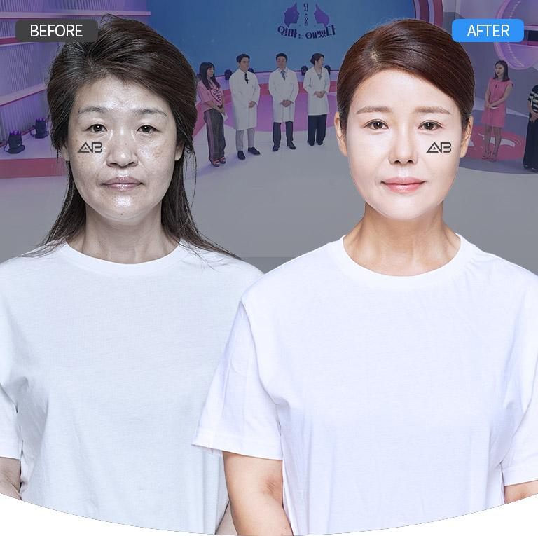 AB PLASTIC SURGERY EVENT