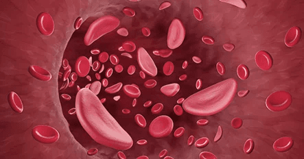 Injeksi Stem Cell Sumsum Tulang