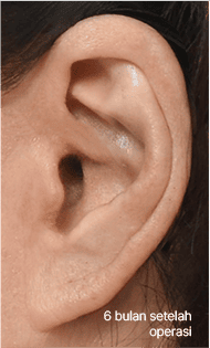 Skill matters in post-surgery scarring too. 3