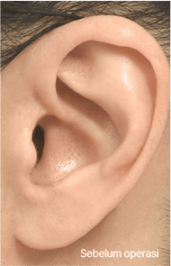 Skill matters in post-surgery scarring too. 1