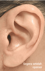 Skill matters in post-surgery scarring too. 2