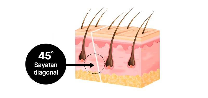 AB’s Key feature