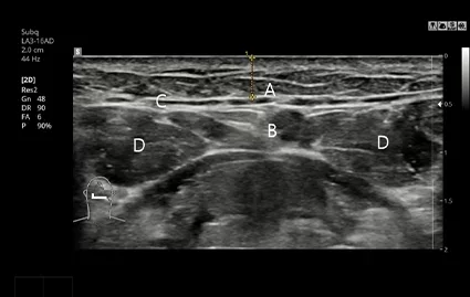 Pemindaian CT Sebelum Operasi