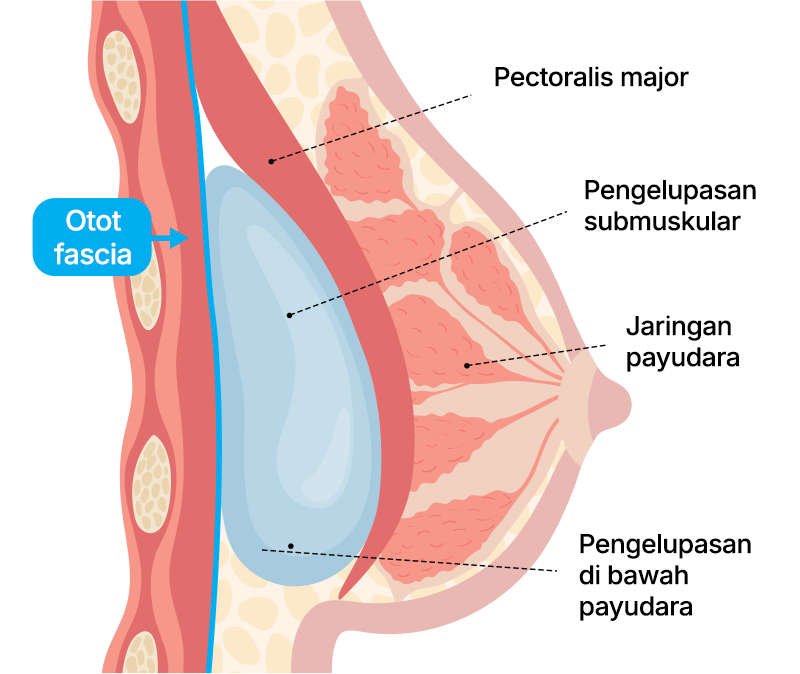 Metode Operasi Dual-Plane