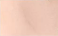 6 bulan setelah operasi